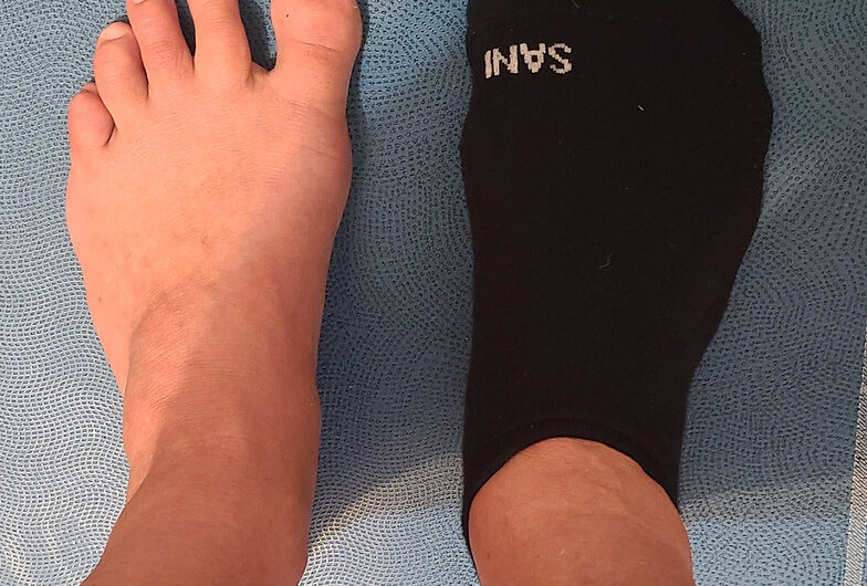 Calcetínes barefoot o calcetínes de 5 dedos. Experiencia propia